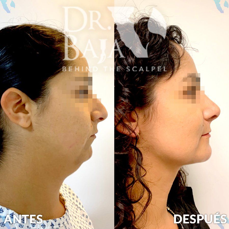 Renato Rodríguez Hirales-8