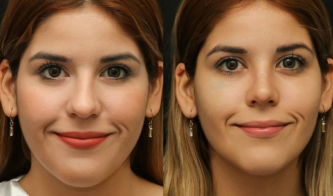 Angel Castro Urquizo-196