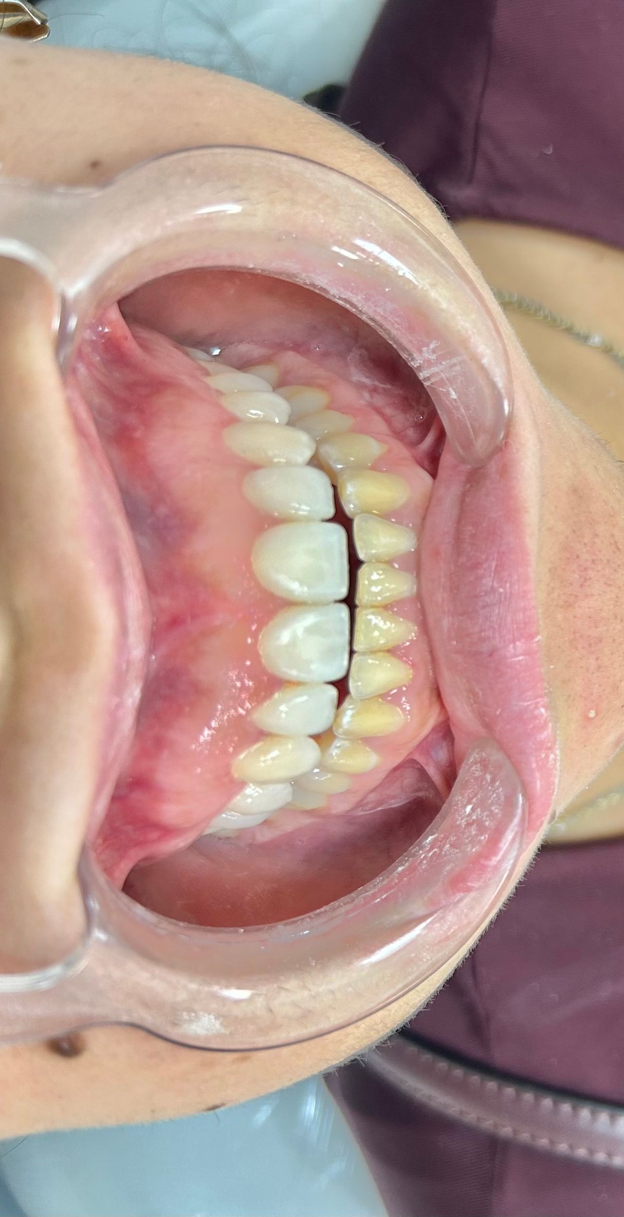 Sergio Bencomo Angulo-5