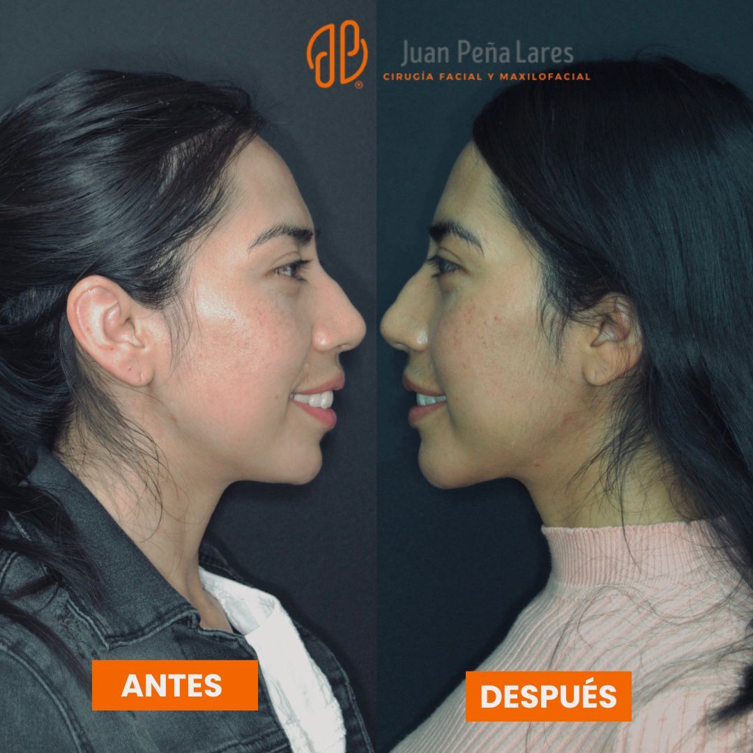 Juan Peña Lares-7