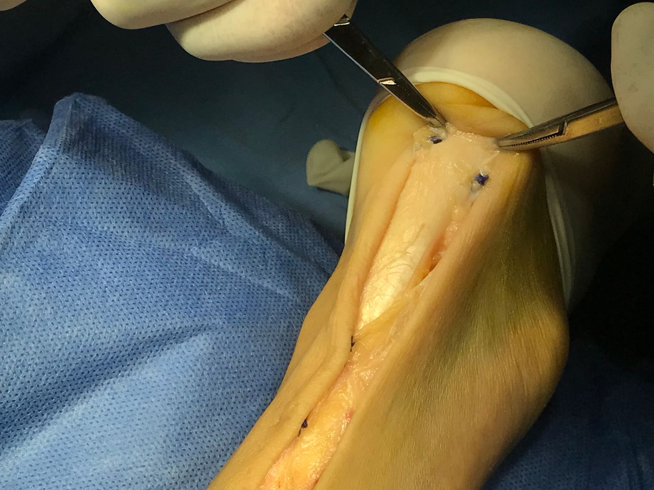 Carlos Alberto Romero Sosa-0