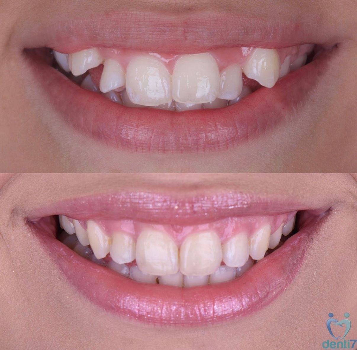 Irving Quezada Lara-17