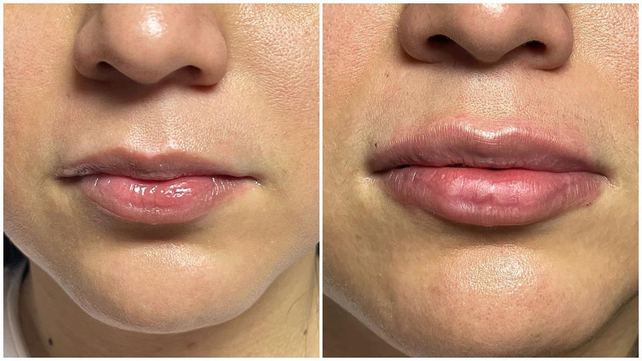 Adrián Martínez Moreno-18