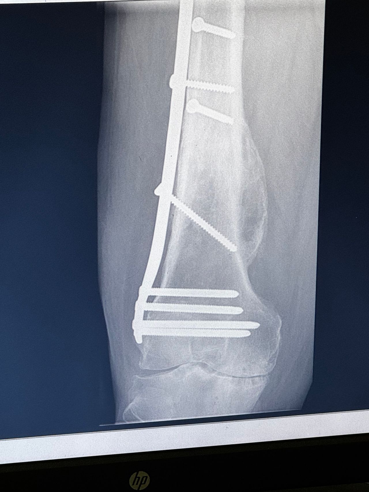 Benjamín Contreras Muñoz-11