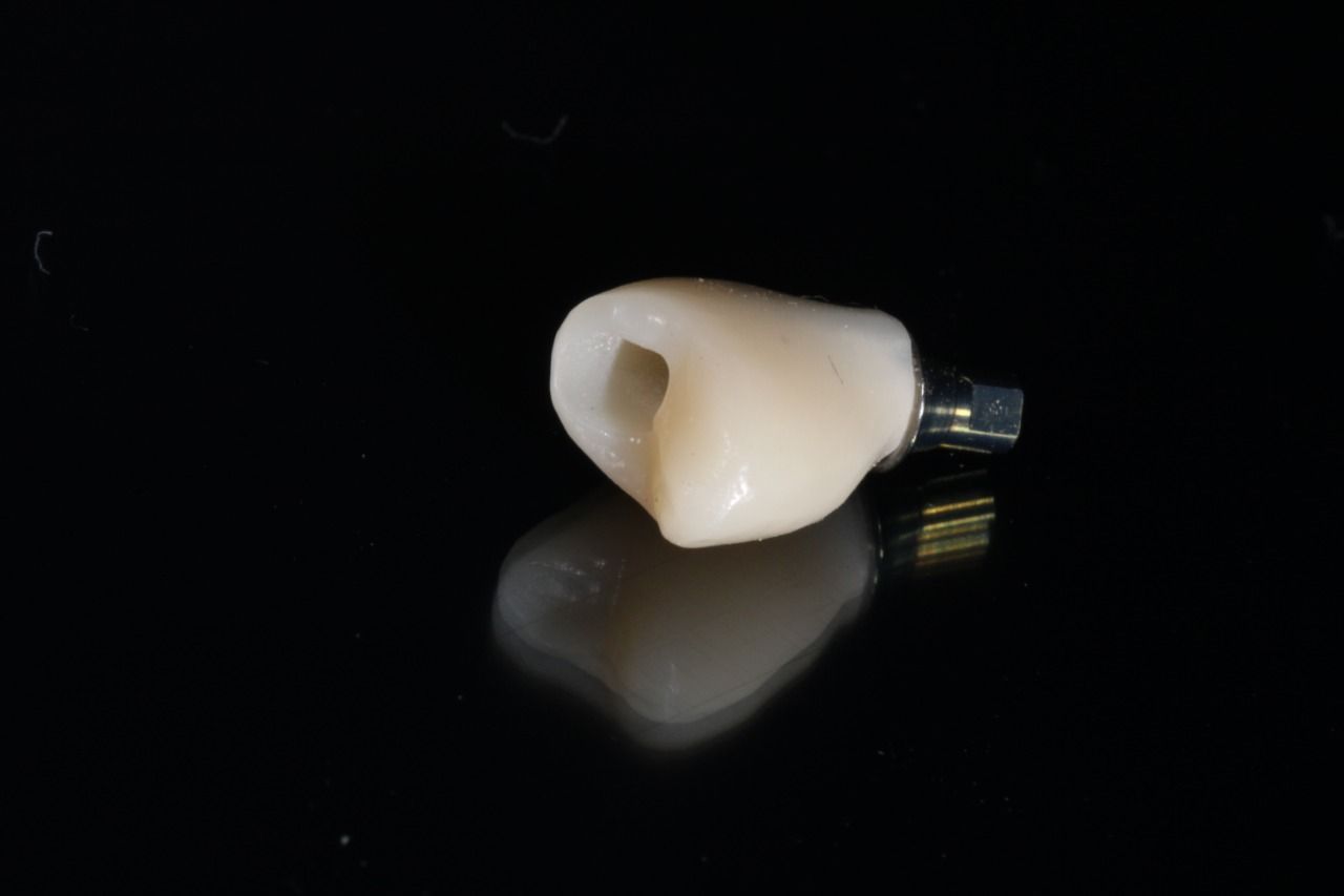 Luis Alonso Flores Reyna-8