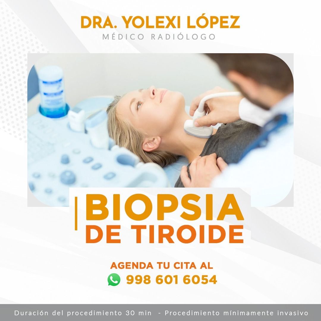 Yolexi López Neyra-3