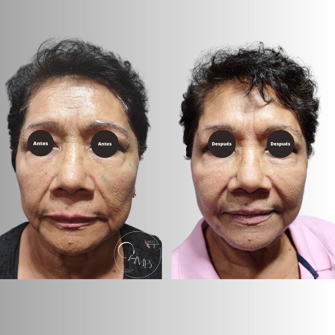 Carlos Alberto Magaña Bustamante-65