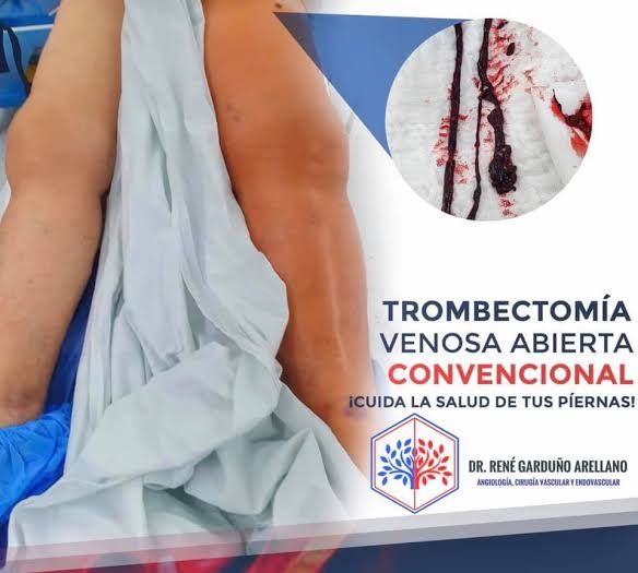 René Garduño Arellano-1