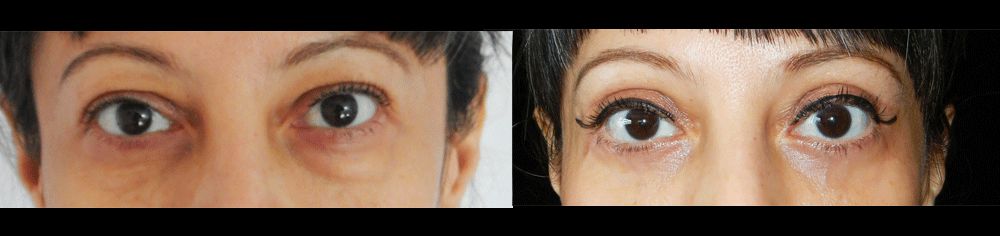 Edgar Ernesto Torres Mejía-23