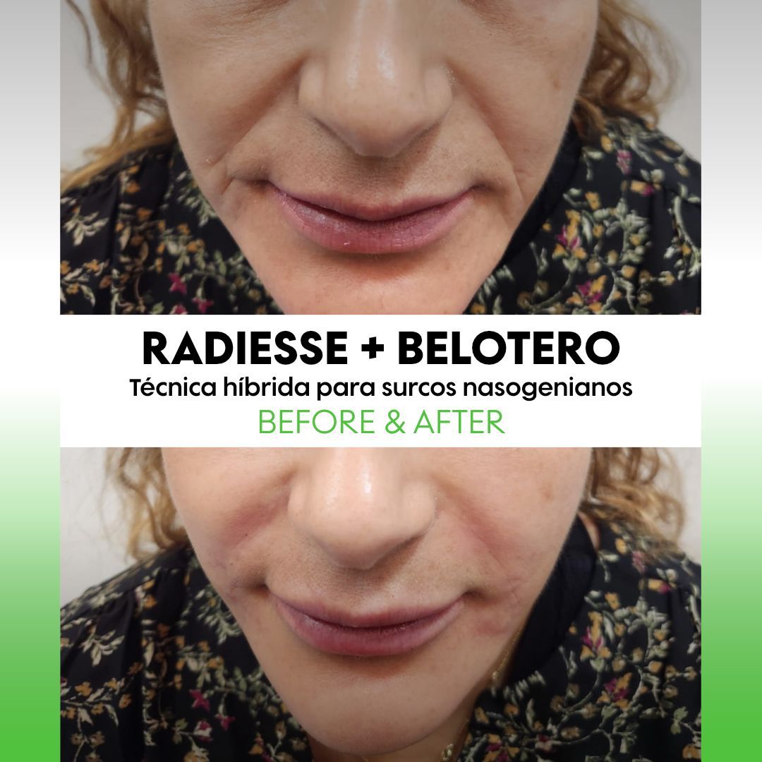 Alejandra Soriano Elorza-109