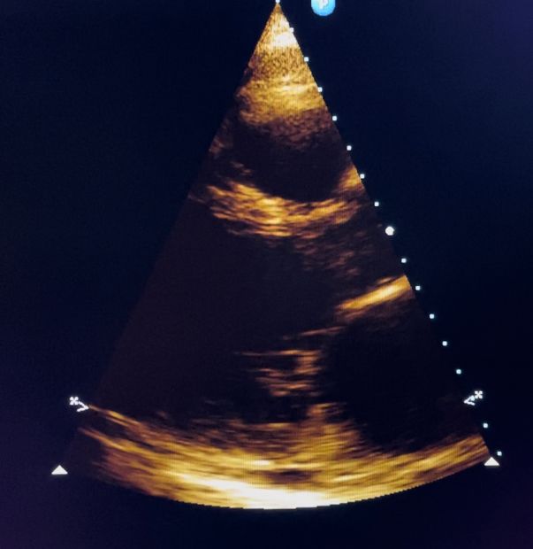 Edgar Ismael Chávez Rayos-16