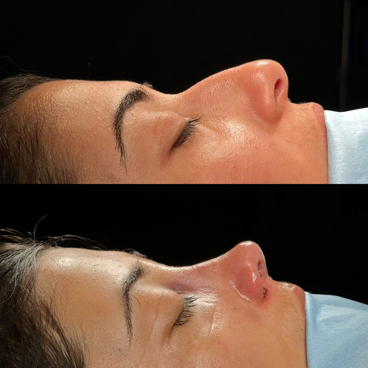 Angel Castro Urquizo-121