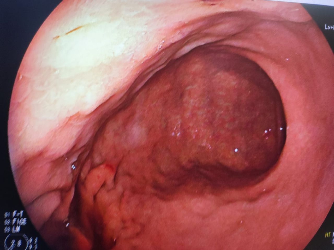 Diana Maritza Valladares Castoño-4