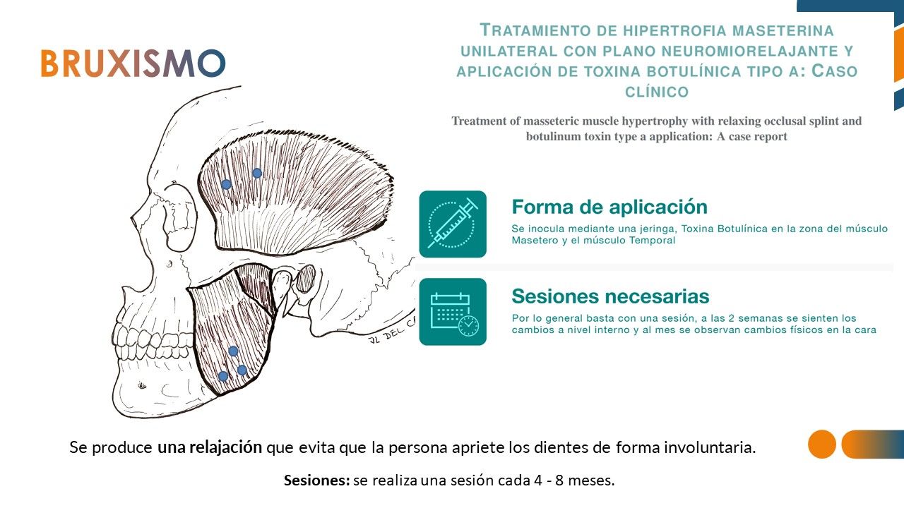 José Luis Muñoz Chapul-33