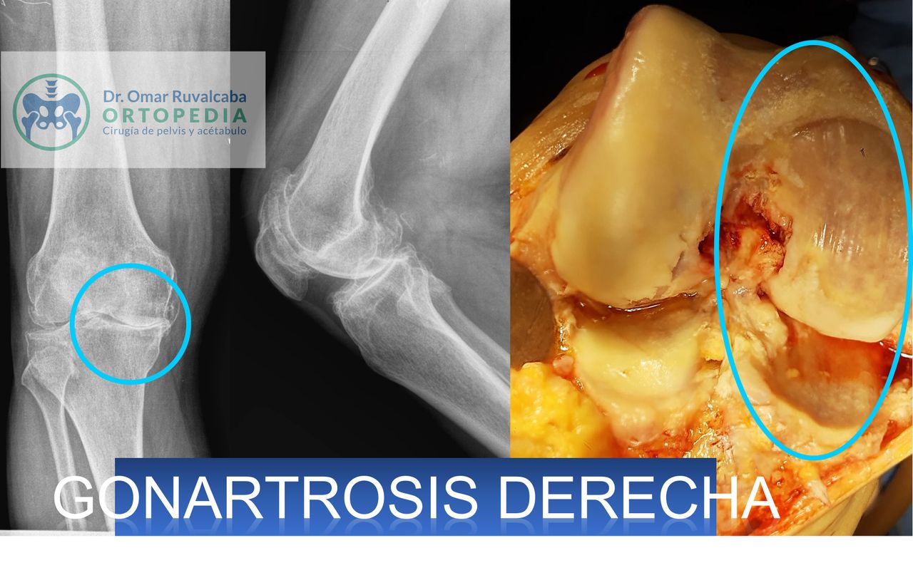 Omar Ruvalcaba Luna-13
