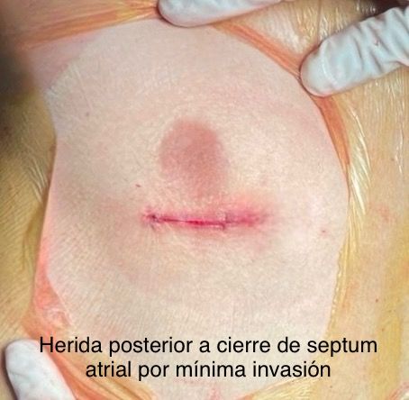 Alfredo Alejandro Paramo Lovera-5