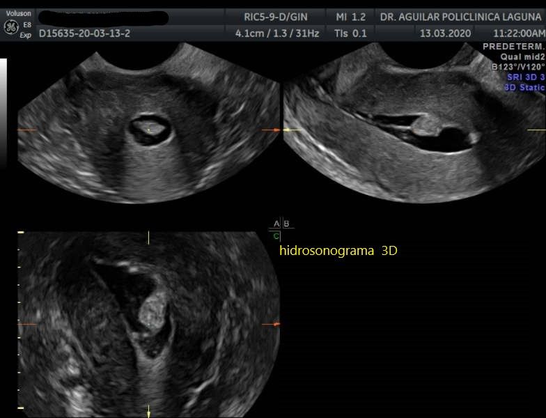 Edgar Fernando Aguilar Morales-2