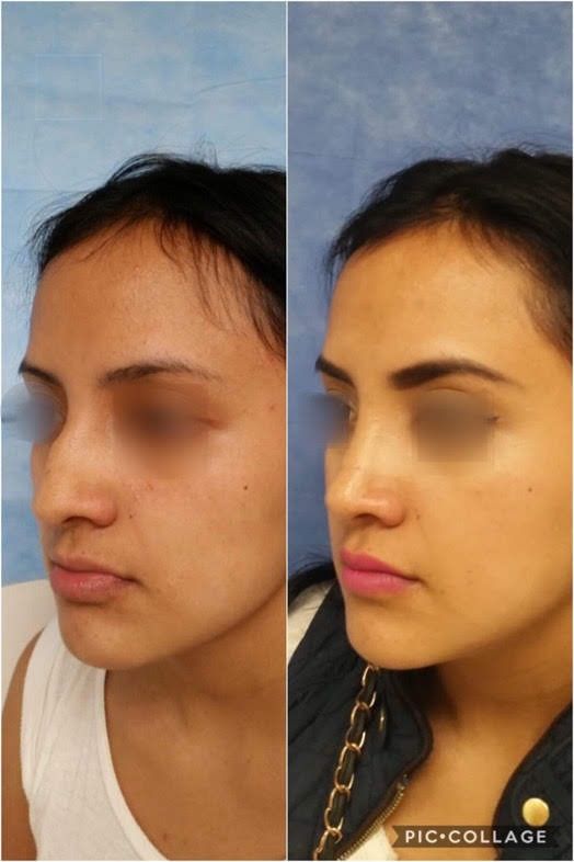 Ana Guadalupe Torres León-1