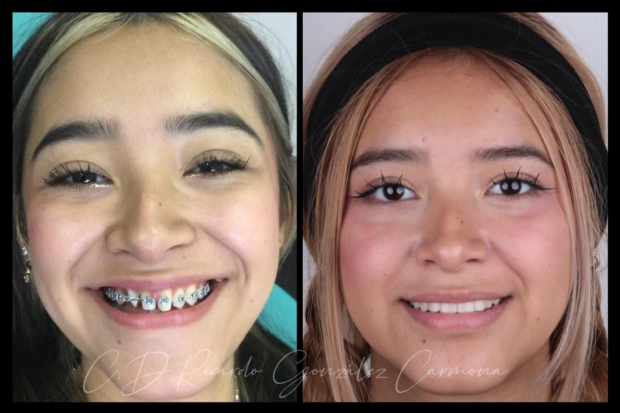 Alicia Carmona López-6