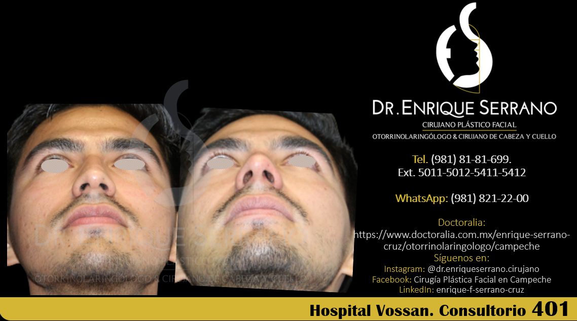 Enrique Serrano Cruz-101