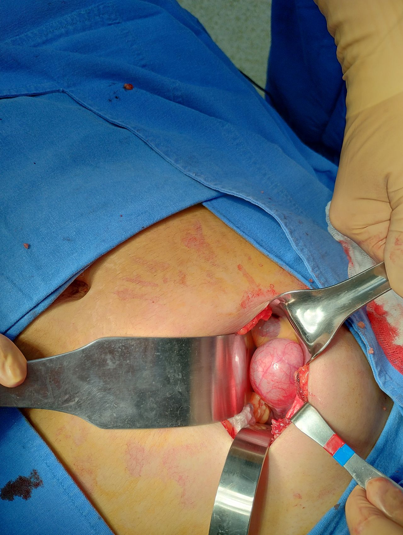 Jose Luis Banda Castillo-3