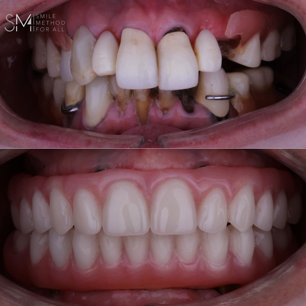 Arturo Mendez Valencia-41