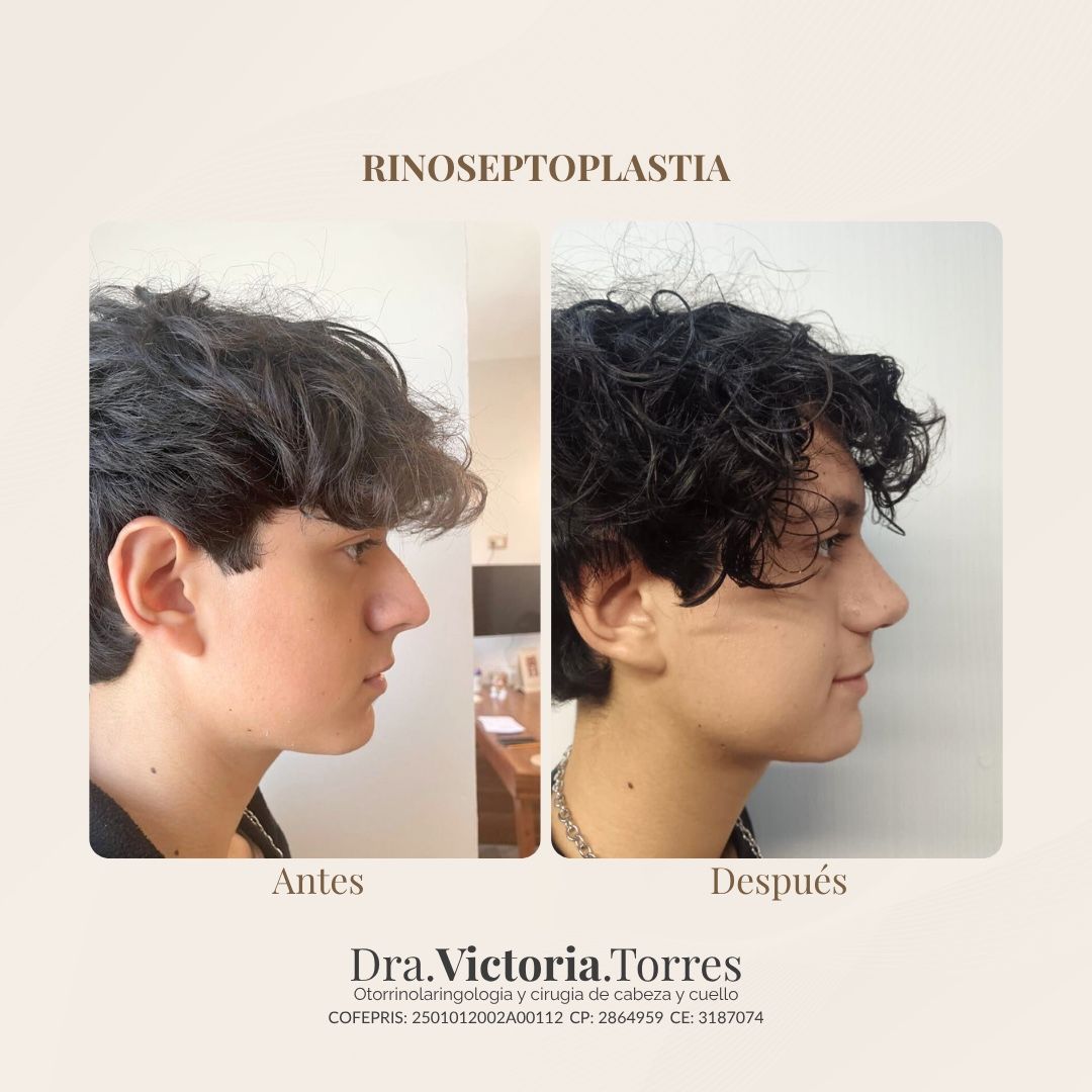 Estela Victoria Torres Galáz-15