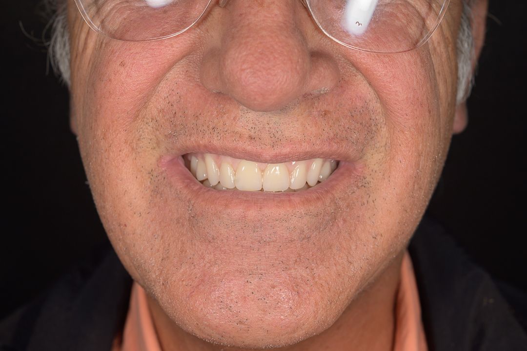 Alam Azael Arrazola González-10