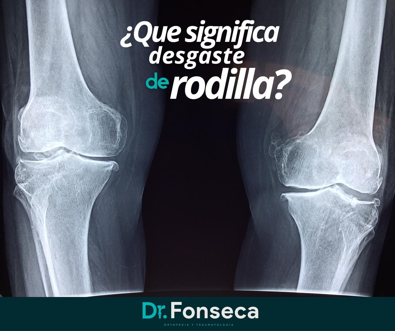 Andres Fonseca G.-5