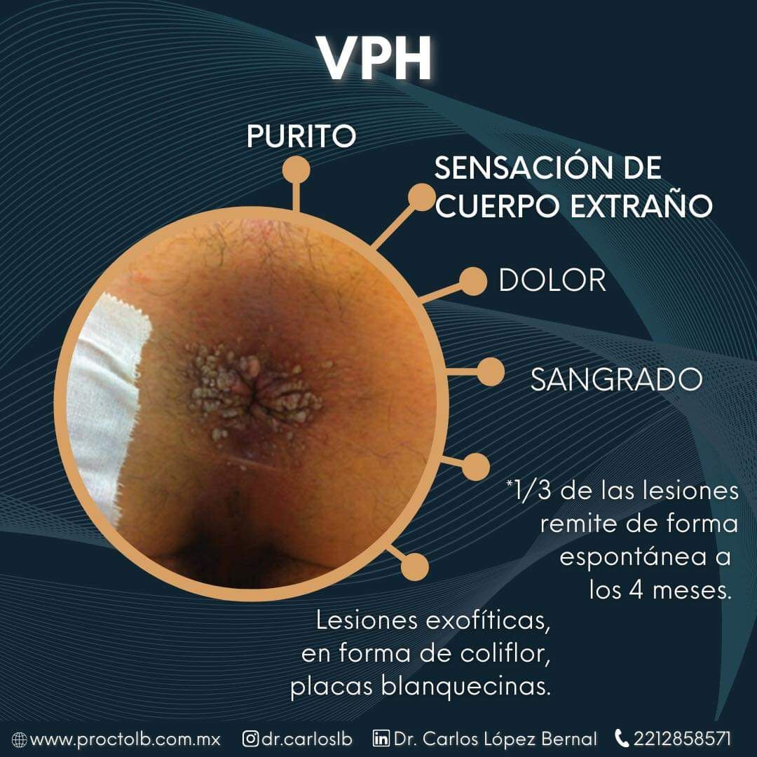 Carlos Alberto López Bernal-14