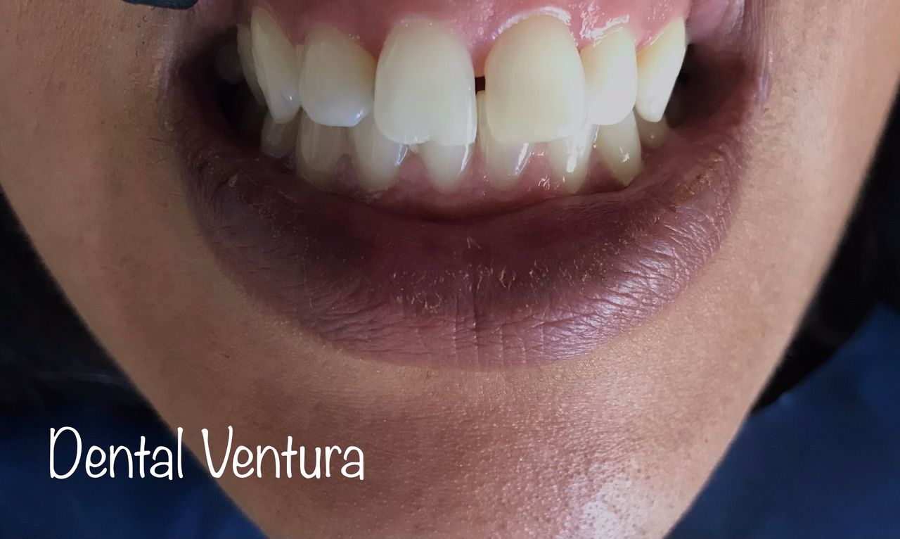 Antonio Cerda Ventura-6