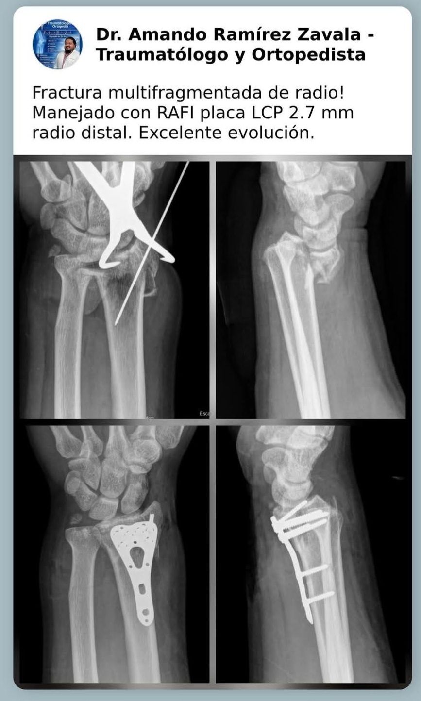 Amando Ramirez Zavala-0