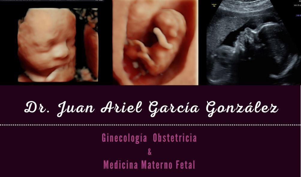 Juan Ariel Garcia Gonzalez-16