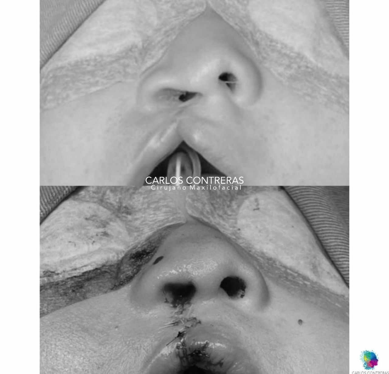 Carlos Ernesto Contreras Castellanos-40