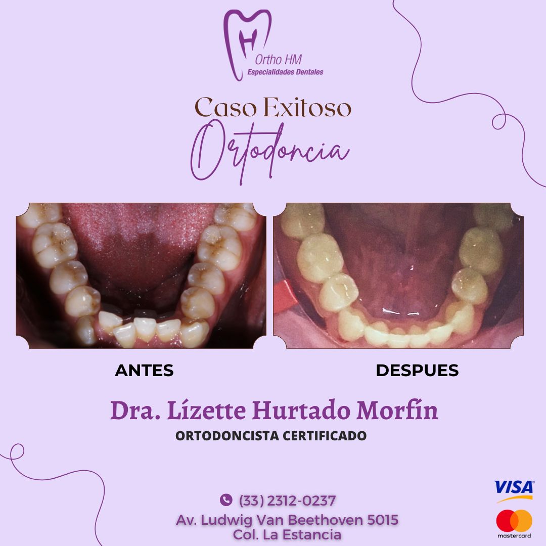 Lizette S. Hurtado Morfin-3