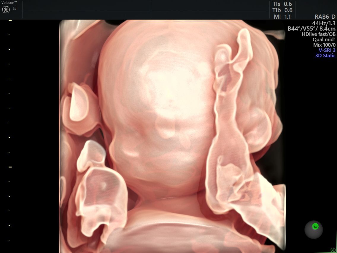 Gila Lili Barrientos Chavez-0