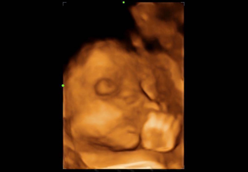 Javier Hernandez Hermenegildo-7