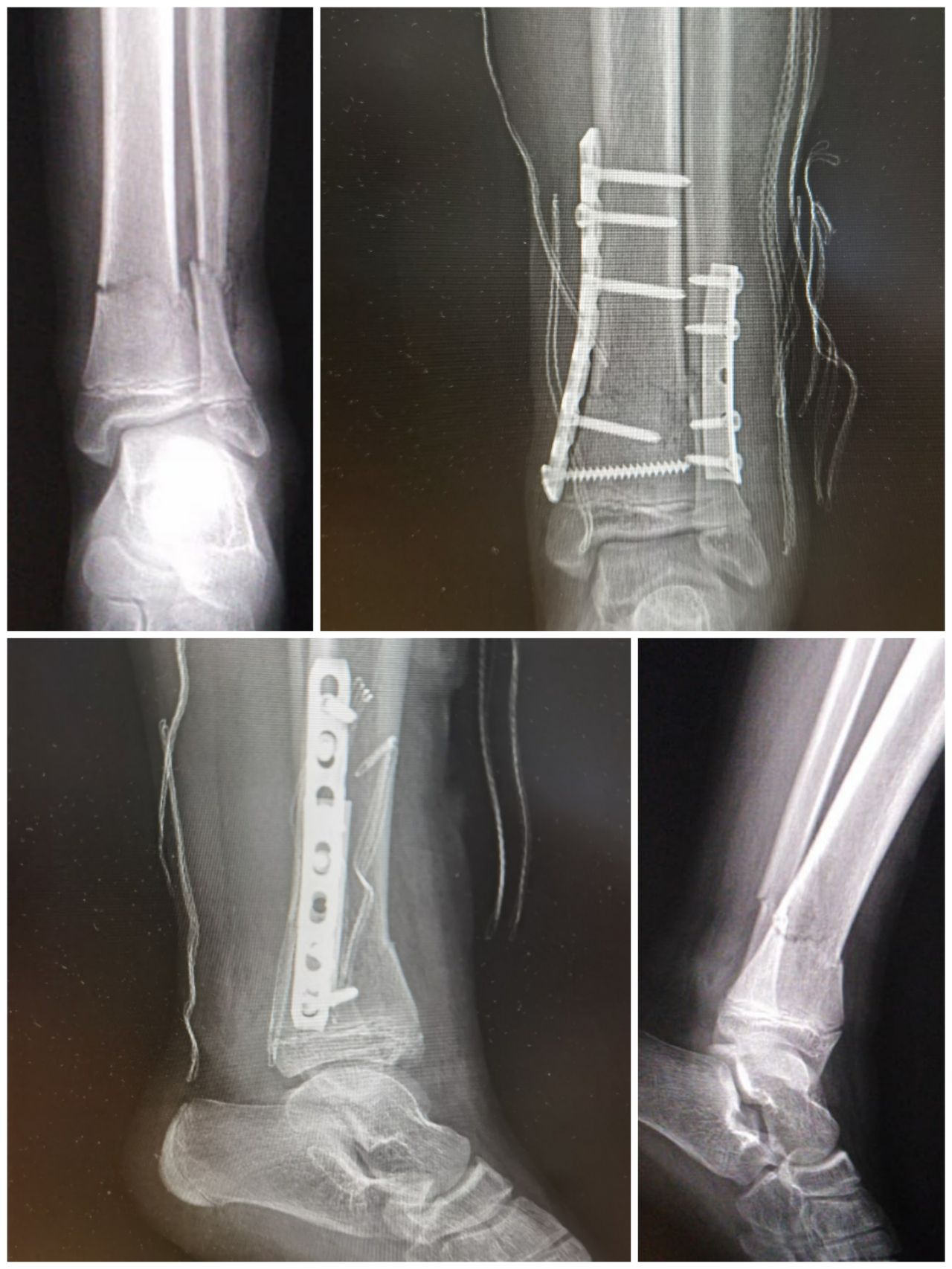 Gabriel De Leon Ochoa Lara-3