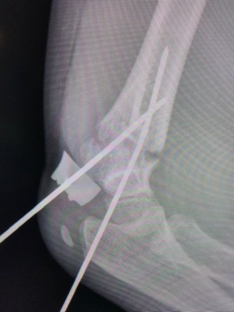 Julián Hernández Anaya-10