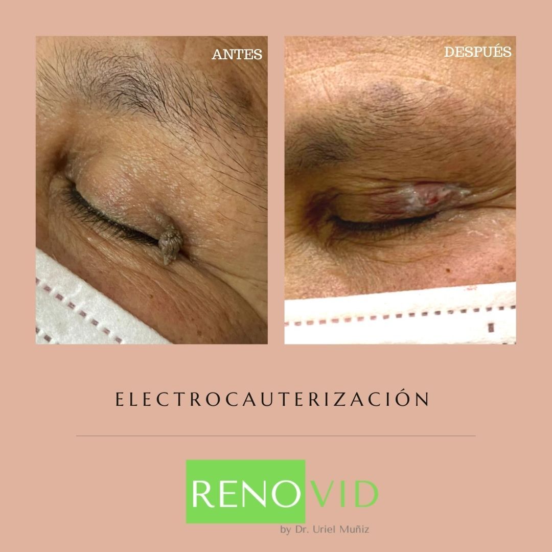 Teófilo Uriel Muñiz Chávez-52