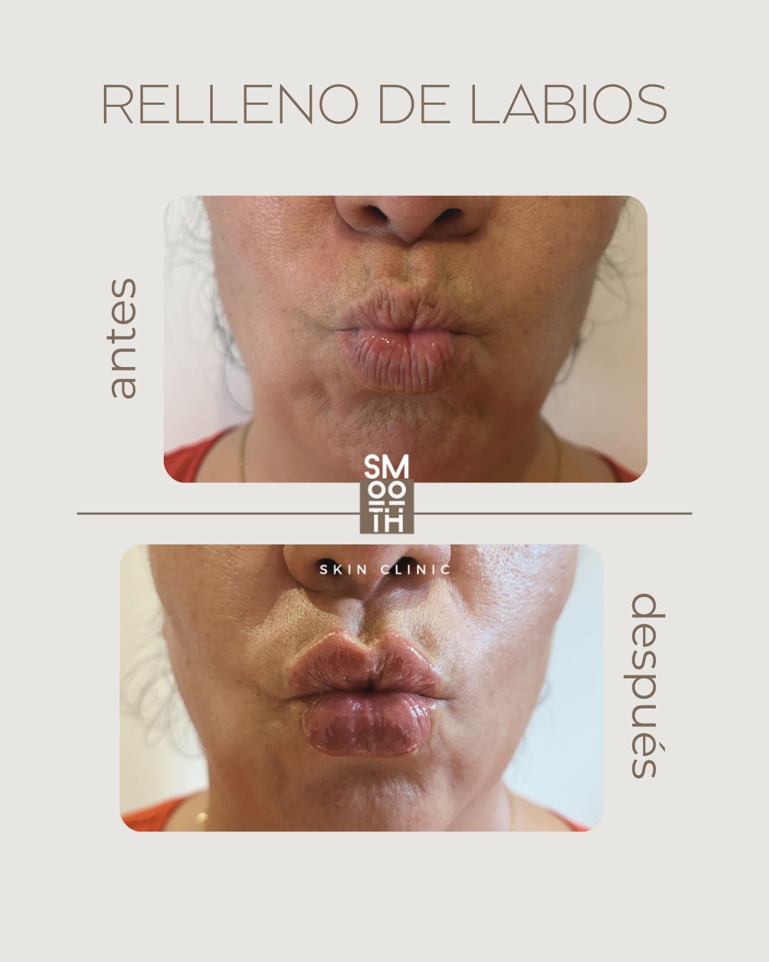 Samantha Martínez-82