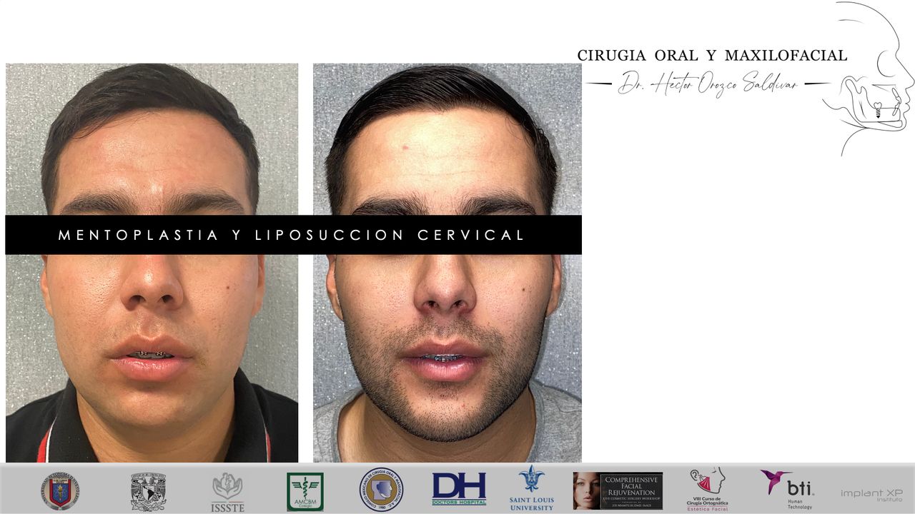 Héctor Adolfo Orozco Saldívar-26