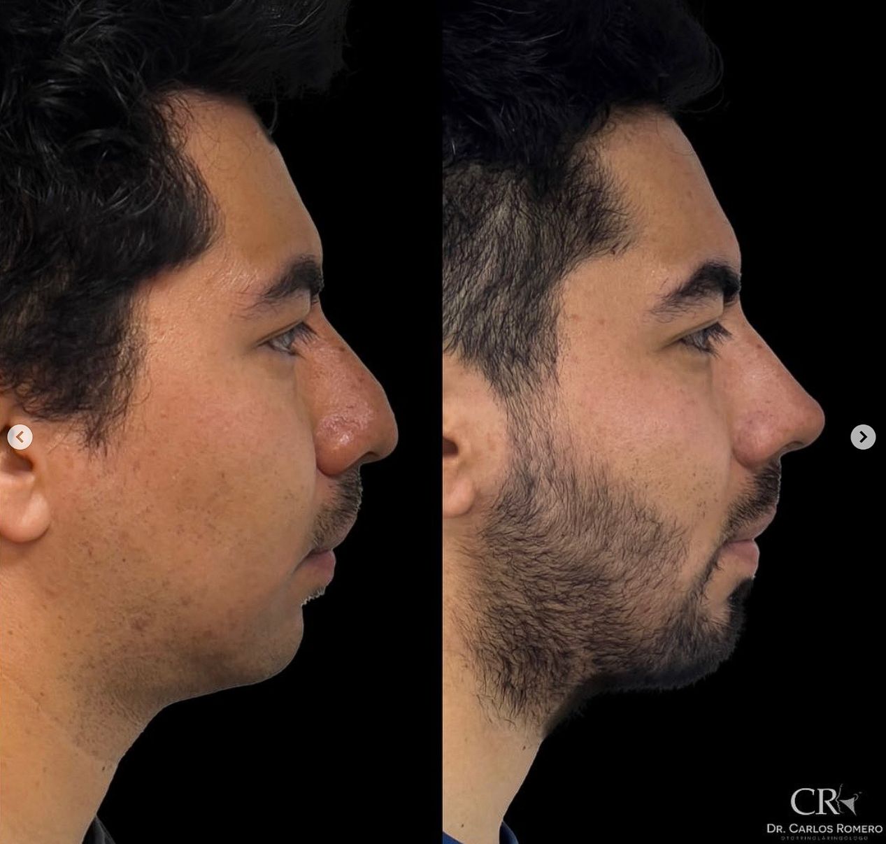 Carlos Alfonso Romero Gameros-24