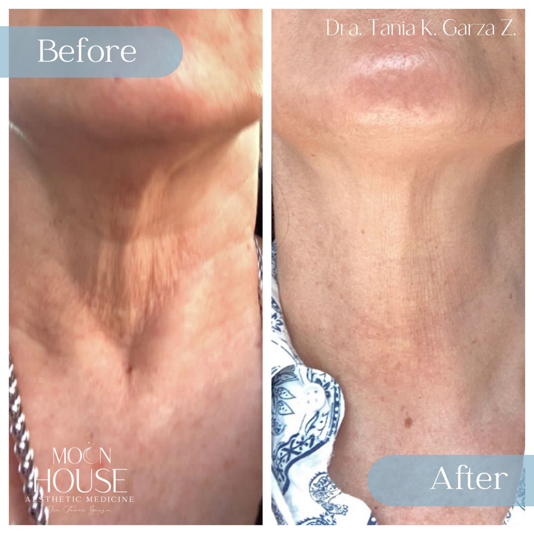 Tania Karine Garza Zepeda-21