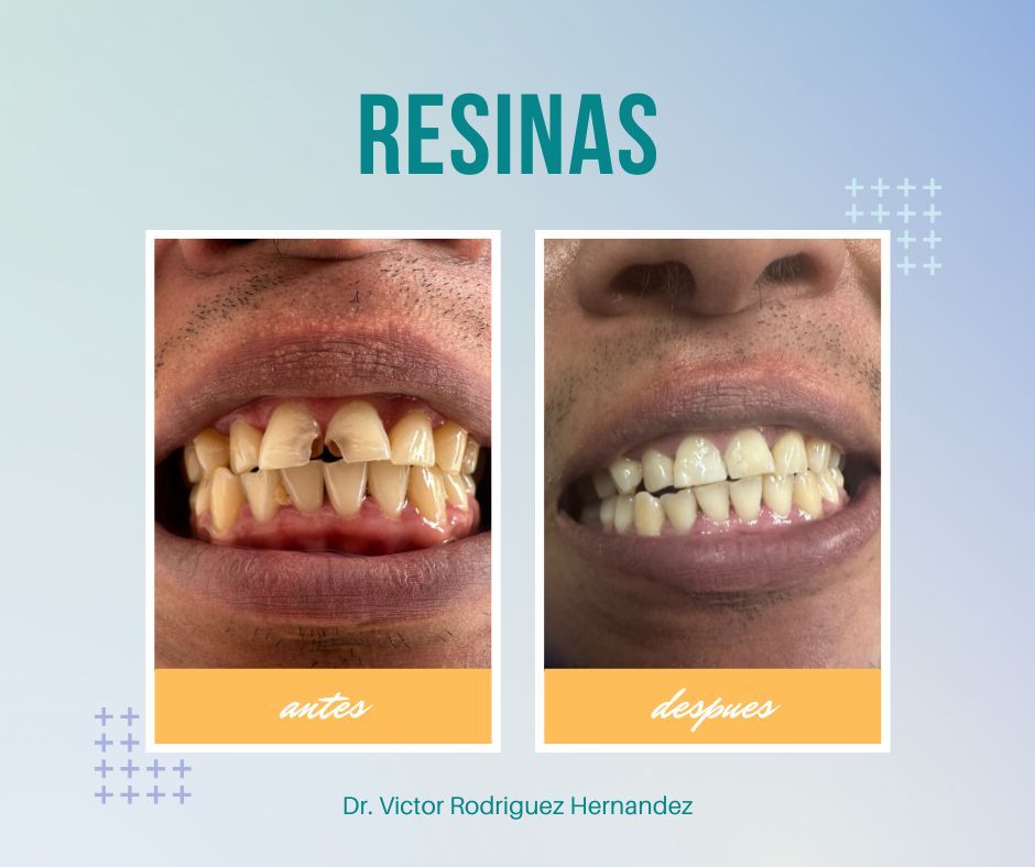 Victor Ramón Rodríguez Hernández-14