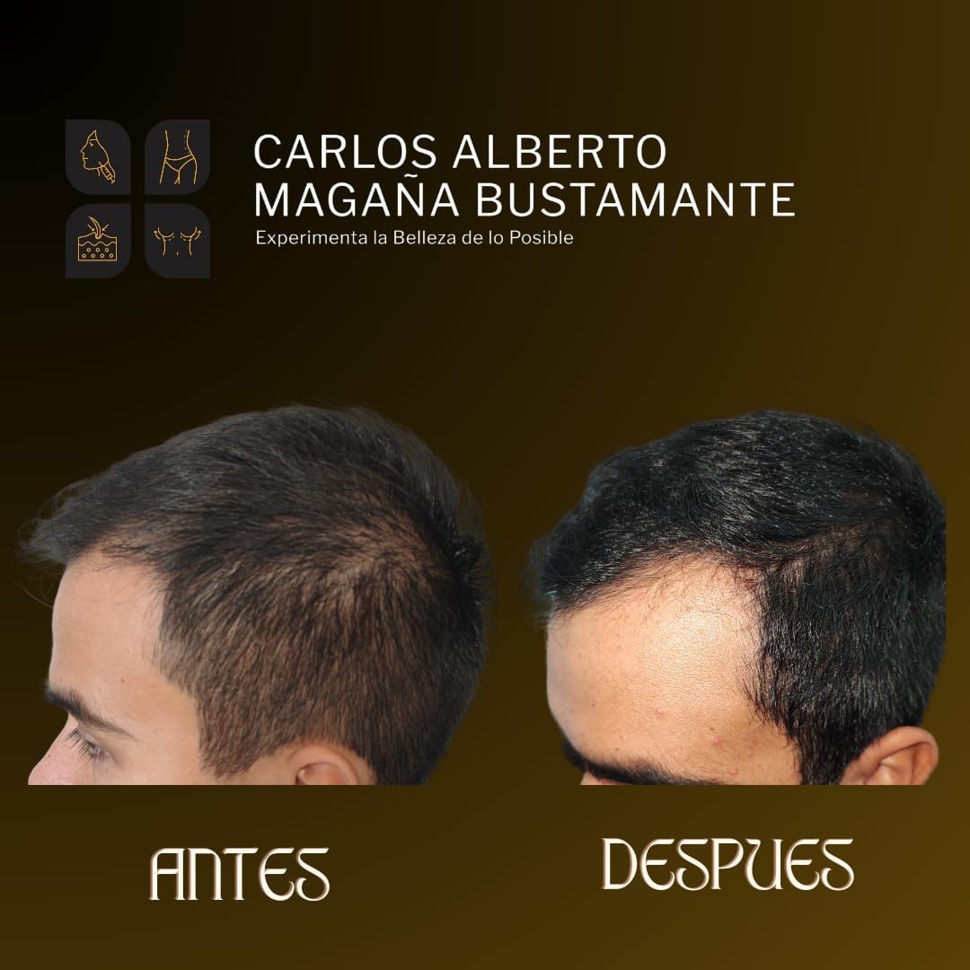 Carlos Alberto Magaña Bustamante-45