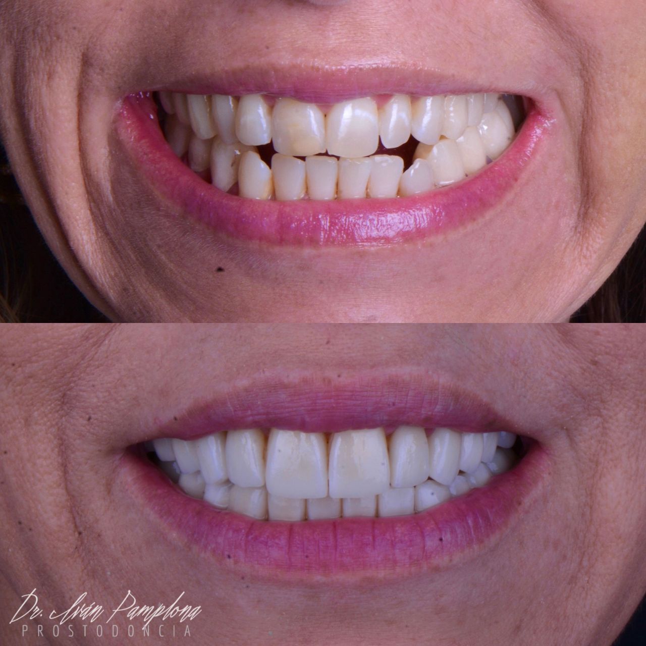 Iván Gerardo Pamplona Alfaro-12