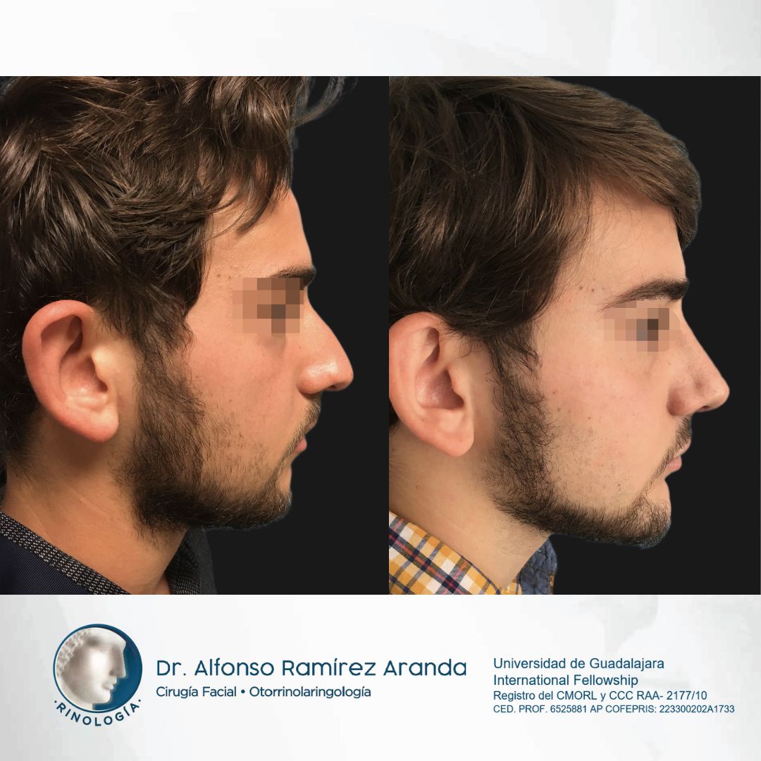 Alfonso Ramírez Aranda-18