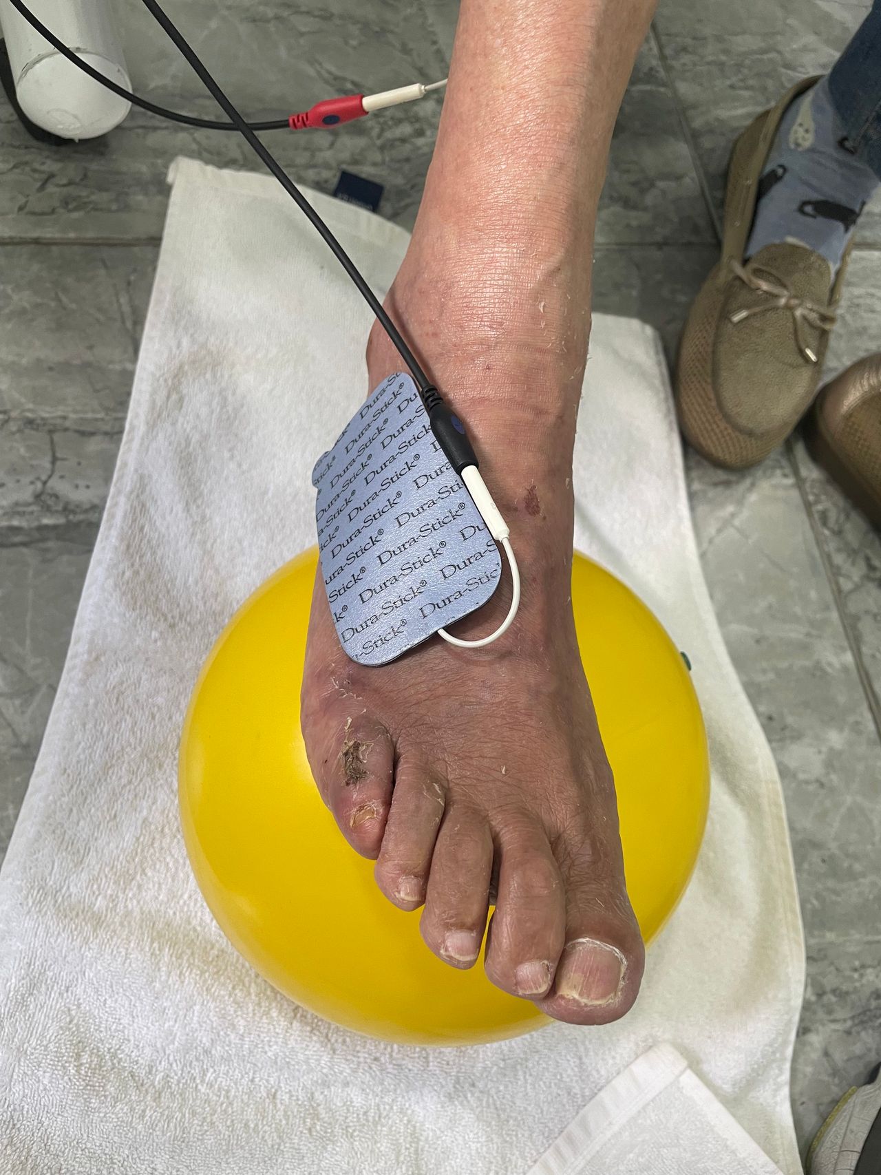 Irving Denilson Peña González-20