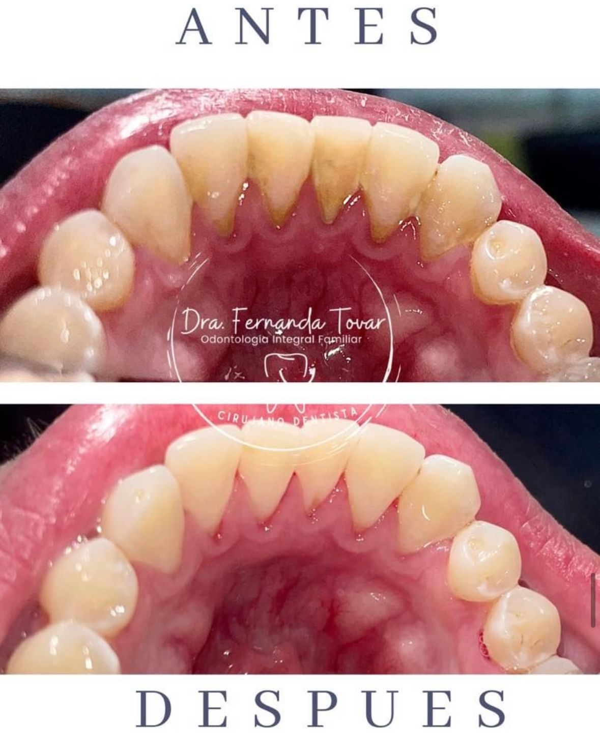 Fernanda Tovar Navarro-10